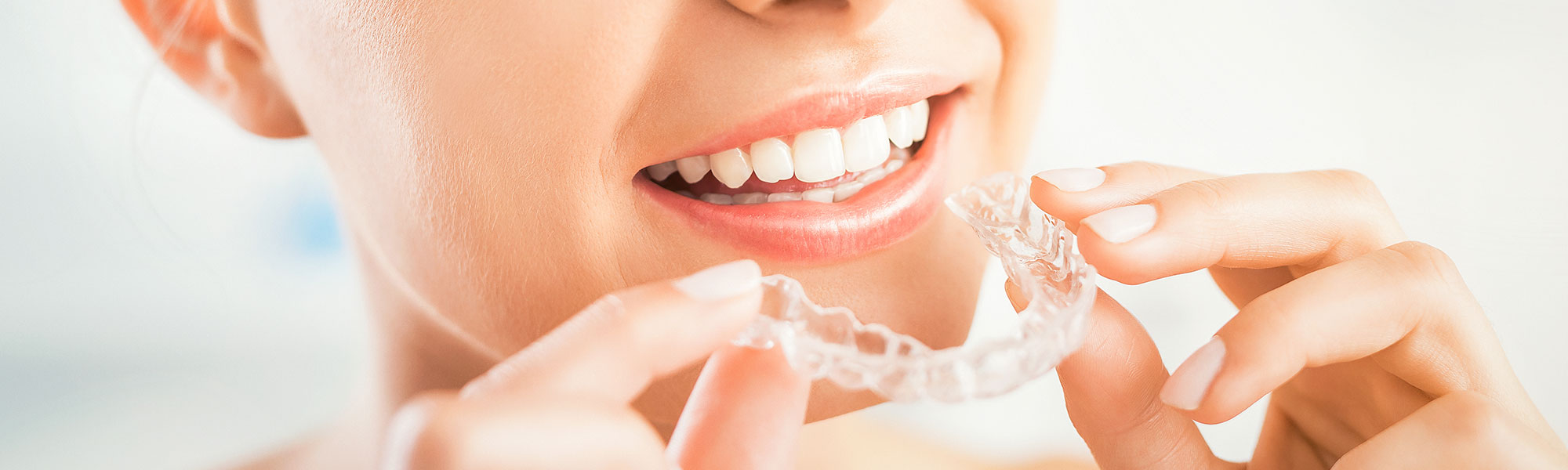 Orthodontic Retainers Long Beach CA