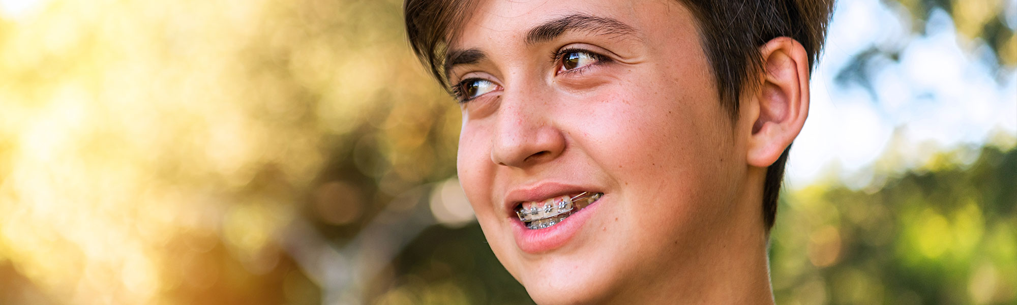 Metal Braces Long Beach CA