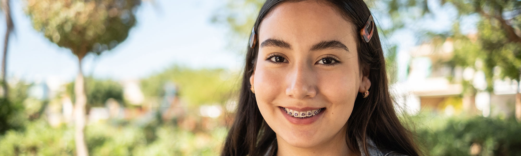 Metal Braces Long Beach CA